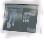 radiologia digitale