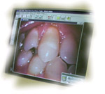 telecamera endo-orale